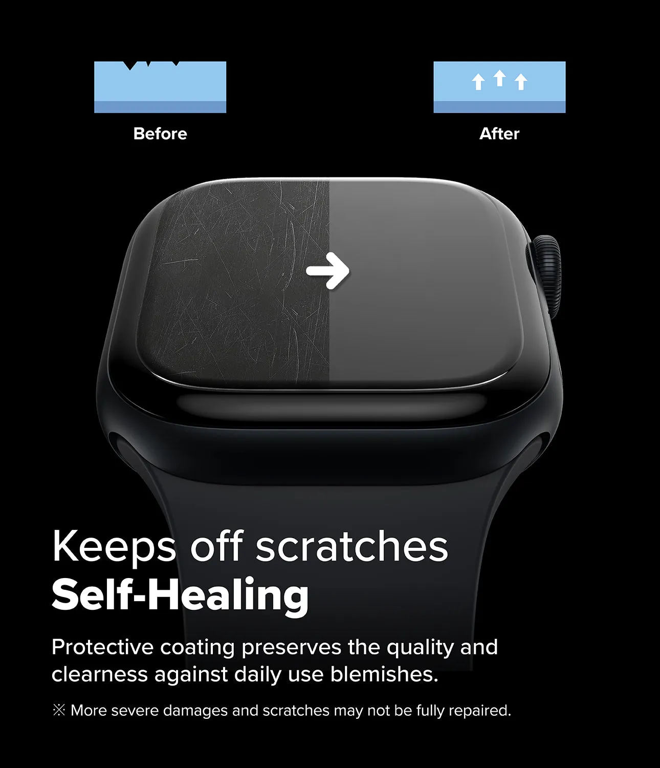 Final Few Apple Watch 10 (42mm) Screen Protector | Dual Easy Film  Stylish & Comfortable